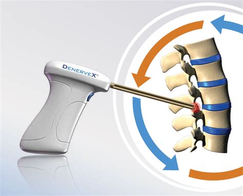 facet joint pronunciation|facet innervation.